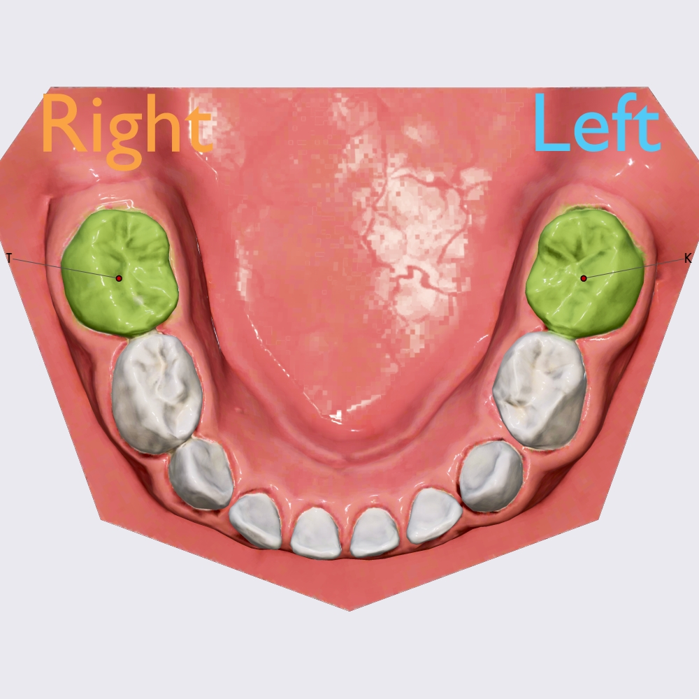 Second mandibular molar tooth